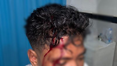 Seorang Remaja Di Desa Labuha: Jadi Korban Pemukulan Oleh Dua Pria Tak Dikenal.